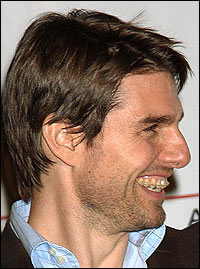 Tom Cruise fogszabályozóval
